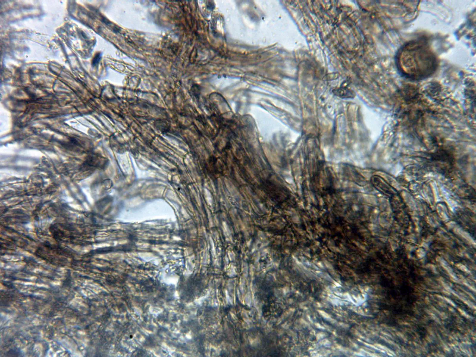 Microscopía de Tricholoma imbricatum - 23 - Cutícula x 400